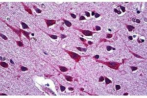 Human Brain, Cortex: Formalin-Fixed, Paraffin-Embedded (FFPE) (CCT5 Antikörper  (AA 1-542))