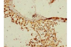 Immunohistochemistry of paraffin-embedded human testis tissue using ABIN7167592 at dilution of 1:100 (RGS14 Antikörper  (AA 230-510))