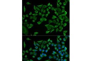 Immunofluorescence analysis of U2OS cells using WARS Polyclonal Antibody (WARS Antikörper)