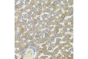 Immunohistochemistry of paraffin-embedded rat liver using CEP164 antibody. (CEP164 Antikörper)