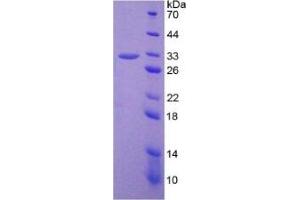SDS-PAGE (SDS) image for Prostaglandin-Endoperoxide Synthase 2 (Prostaglandin G/H Synthase and Cyclooxygenase) (PTGS2) ELISA Kit (ABIN6574191)
