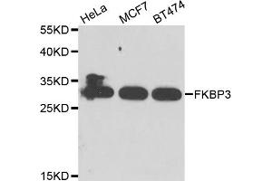 Western blot analysis of extracts of various cell lines, using FKBP3 antibody. (FKBP3 Antikörper)
