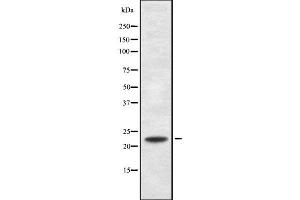 Western blot analysis of RANBP1 using MCF7 whole cell lysates (RANBP1 Antikörper  (N-Term))