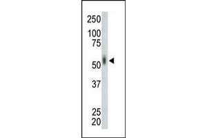 Western Blotting (WB) image for anti-MAP Kinase Interacting serine/threonine Kinase 2 (MKNK2) (AA 70-100), (N-Term) antibody (ABIN391072)
