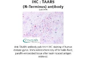 Image no. 1 for anti-Trace Amine Associated Receptor 5 (TAAR5) (Extracellular Domain), (N-Term) antibody (ABIN1739862) (TAAR5 Antikörper  (Extracellular Domain, N-Term))