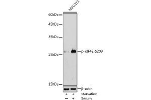 Western blot analysis of extracts of NIH/3T3 cells, using Phospho-eIF4E-S209 antibody (ABIN6135213, ABIN6136062, ABIN6136063 and ABIN6225650) at 1:500 dilution. (EIF4E Antikörper  (pSer209))