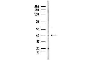 anti-Desert Hedgehog (DHH) (N-Term) antibody