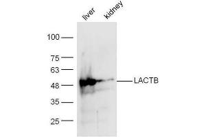 Mouse liver/kidney lysates probed with Anti-LACTB Polyclonal Antibody  at 1:5000 90min in 37˚C.