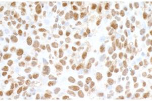 Immunohistochemistry (IHC) image for anti-Fused in Sarcoma (FUS) (AA 1-50) antibody (ABIN7454040) (Rekombinanter FUS Antikörper  (AA 1-50))