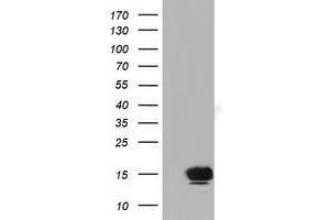 Western Blotting (WB) image for anti-Follicle Stimulating Hormone, beta Polypeptide (FSHB) antibody (ABIN1498319)