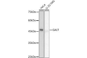 Western blot analysis of extracts of various cell lines, using GALT antibody (ABIN7267332) at 1:500 dilution. (GALT Antikörper)