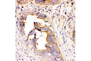IHC analysis of DHFR using anti-DHFR antibody (ABIN6719418). (Dihydrofolate Reductase Antikörper  (AA 2-187))