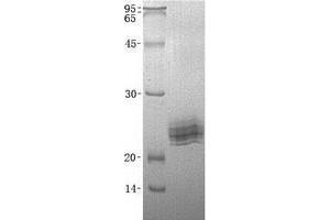 Western Blotting (WB) image for Leukocyte-Associated Immunoglobulin-Like Receptor 2 (LAIR2) (Transcript Variant 1) protein (His tag) (ABIN2713632)