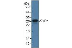 Detection of Recombinant JAM1, Human using Polyclonal Antibody to Junctional Adhesion Molecule 1 (JAM1) (F11R Antikörper  (AA 64-249))