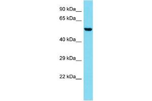 Host: Rabbit  Target Name: Coro2b  Sample Tissue: Mouse Lung lysates  Antibody Dilution: 1. (CORO2B Antikörper  (N-Term))