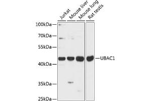 Western blot analysis of extracts of various cell lines, using UB antibody (ABIN6133006, ABIN6149772, ABIN6149773 and ABIN6216923) at 1:3000 dilution. (UBAC1 Antikörper  (AA 176-405))