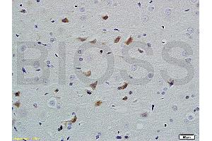 Formalin-fixed and paraffin embedded rat brain labeled with Anti PHAP1 Polyclonal Antibody, Unconjugated (ABIN762176) at 1:200 followed by conjugation to the secondary antibody and DAB staining