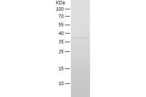 Western Blotting (WB) image for Interferon Induced Transmembrane Protein 2 (IFITM2) (AA 1-132) protein (His-IF2DI Tag) (ABIN7123491) (IFITM2 Protein (AA 1-132) (His-IF2DI Tag))