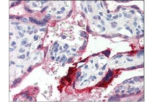 Human Placenta (formalin-fixed, paraffin-embedded) stained with ANXA1at 4 µg/ml followed by biotinylated anti-goat IgG secondary antibody, alkaline phosphatase-streptavidin and chromogen. (Annexin a1 Antikörper  (C-Term))