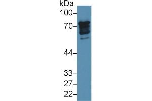 Detection of EPN1 in Human 293T cell lysate using Polyclonal Antibody to Epsin 1 (EPN1) (Epsin 1 Antikörper  (AA 279-437))