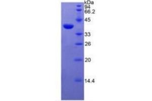 SDS-PAGE of Protein Standard from the Kit (Highly purified E. (EGFR ELISA Kit)