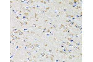 Immunohistochemistry of paraffin-embedded Rat brain using YWHAZ Polyclonal Antibody at dilution of 1:100 (40x lens). (14-3-3 zeta Antikörper)