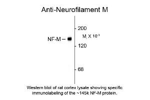 Western blot of Anti-Neurofilament M (Chicken) Antibody - 212-901-D84 Western Blot of Chicken anti-Neurofilament M antibody. (NEFM Antikörper  (C-Term))
