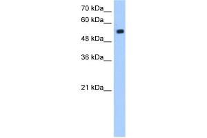 WB Suggested Anti-ZIK1 Antibody Titration:  1. (ZIK1 Antikörper  (N-Term))