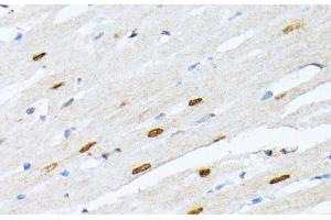 Immunohistochemistry of paraffin-embedded Rat heart using TriMethyl-Histone H3-K27 Polyclonal Antibody at dilution of 1:100 (40x lens).