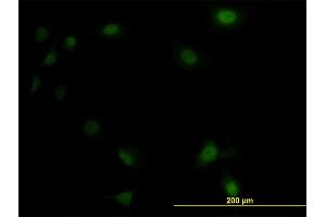 Immunofluorescence of monoclonal antibody to UBE2M on HeLa cell. (UBE2M Antikörper  (AA 1-183))