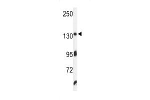 Western blot analysis of ZO1 Antibody in K562 cell line lysates (35ug/lane) (TJP1 Antikörper  (C-Term))