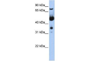 WB Suggested Anti-MNAT1 Antibody Titration:  0. (MNAT1 Antikörper  (N-Term))