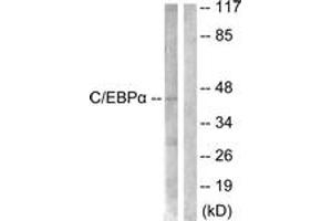 Western blot analysis of extracts from 293 cells, treated with Insulin 0. (CEBPA Antikörper  (AA 6-55))