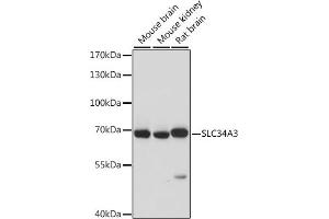 Western blot analysis of extracts of various cell lines, using SLC34 antibody (ABIN7270451) at 1:1000 dilution. (SLC34A3 Antikörper  (AA 210-320))