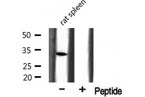 Western blot analysis of extracts from rat spleen, using BST1 antibody. (BST1 Antikörper  (Internal Region))