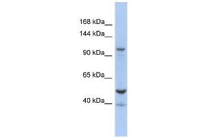 DDX58 antibody used at 1 ug/ml to detect target protein.