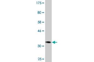 Western Blot detection against Immunogen (36. (DVL3 Antikörper  (AA 1-100))