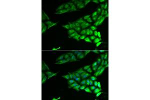 Immunofluorescence analysis of U2OS cell using PSAT1 antibody. (PSAT1 Antikörper)