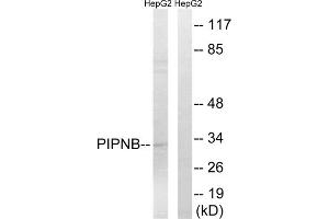 Western blot analysis of extracts from HepG2 cells, using PITPNB antibody. (PITPNB Antikörper  (Internal Region))