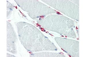 Human Skeletal Muscle: Formalin-Fixed, Paraffin-Embedded (FFPE)