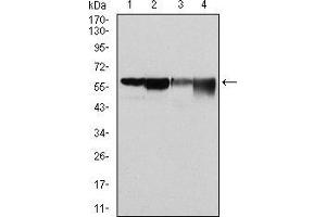 Western blot analysis using G6PD mouse mAb against Hela (1), MCF-7 (2), Jurkat (3) and K562 (4) cell lysate. (Glucose-6-Phosphate Dehydrogenase Antikörper)