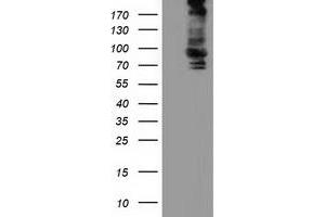 Western Blotting (WB) image for anti-Aldehyde Dehydrogenase 1 Family, Member L1 (ALDH1L1) antibody (ABIN1496583) (ALDH1L1 Antikörper)