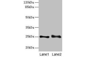 Western blot All lanes: RAB3B antibody at 4 μg/mL Lane 1: Mouse brain tissue Lane 2: U87 whole cell lysate Secondary Goat polyclonal to rabbit IgG at 1/10000 dilution Predicted band size: 25 kDa Observed band size: 25 kDa (RAB3B Antikörper  (AA 1-219))