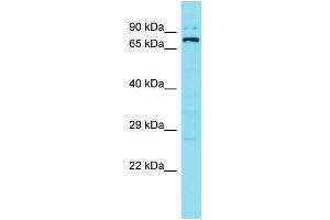 Western Blotting (WB) image for anti-Sosondowah Ankyrin Repeat Domain Family Member B (SOWAHB) (C-Term) antibody (ABIN2791404) (SOWAHB Antikörper  (C-Term))