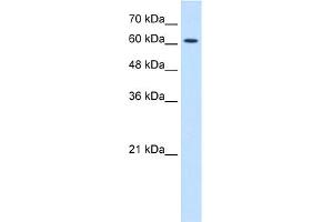 WB Suggested Anti-CHRNE Antibody Titration:  1. (CHRNE Antikörper  (N-Term))