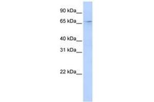 Image no. 1 for anti-APOBEC1 Complementation Factor (A1CF) (N-Term) antibody (ABIN6740710)