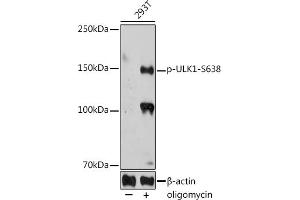 Western blot analysis of extracts of 293T cells, using Phospho-ULK1-S638 antibody (ABIN7271219) at 1:1000 dilution. (ULK1 Antikörper  (pSer638))