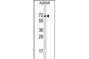 GEE2 Antibody (C-term) (ABIN657099 and ABIN2837895) western blot analysis in  cell line lysates (35 μg/lane). (MAGEE2 Antikörper  (C-Term))