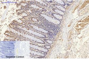 Immunohistochemical analysis of paraffin-embedded human colon tissue.