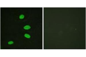 Immunofluorescence analysis of HeLa cells, using RBL2 (Ab-952) Antibody. (p130 Antikörper  (AA 918-967))